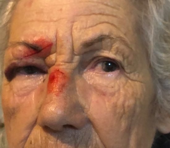 gallbladderliver Koureli Eleytheria